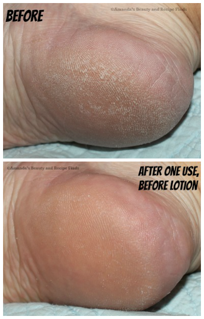 2 Quick and Easy Steps To Soft, Silky Smooth Feet