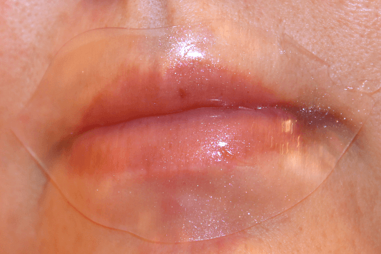 patchology lip gel mask